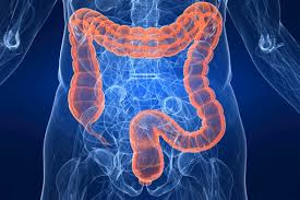 CONGRESSO Malattie Infiammatorie Intestinali Croniche: Ubinam sumus, quo vadimus, quo usque tandem?